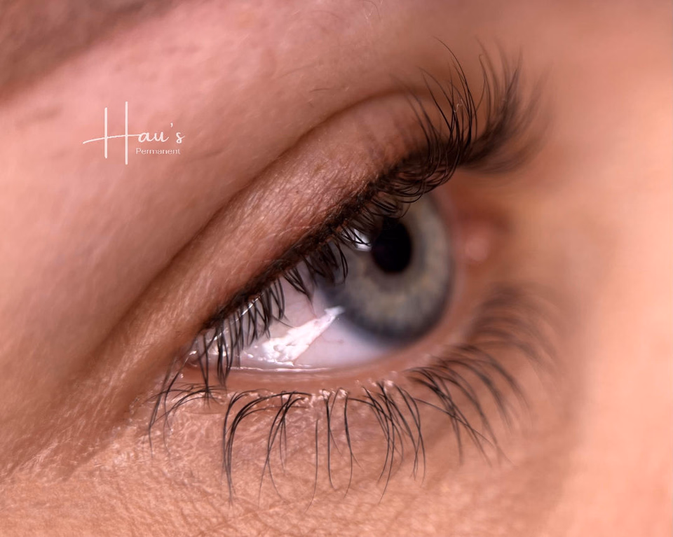 Wimpernkranzpigmentierung