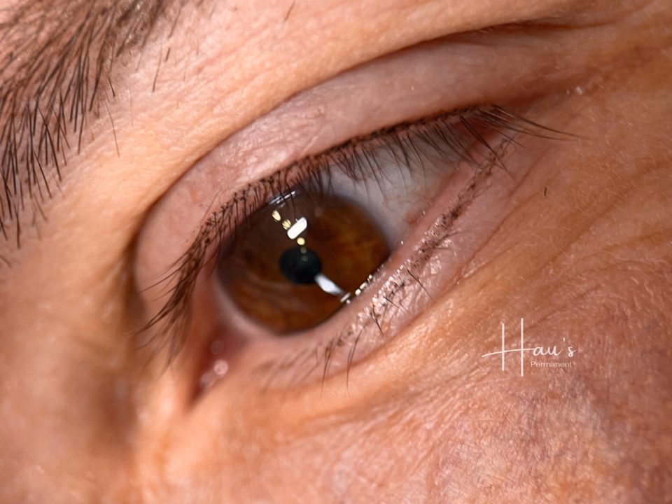 Augen